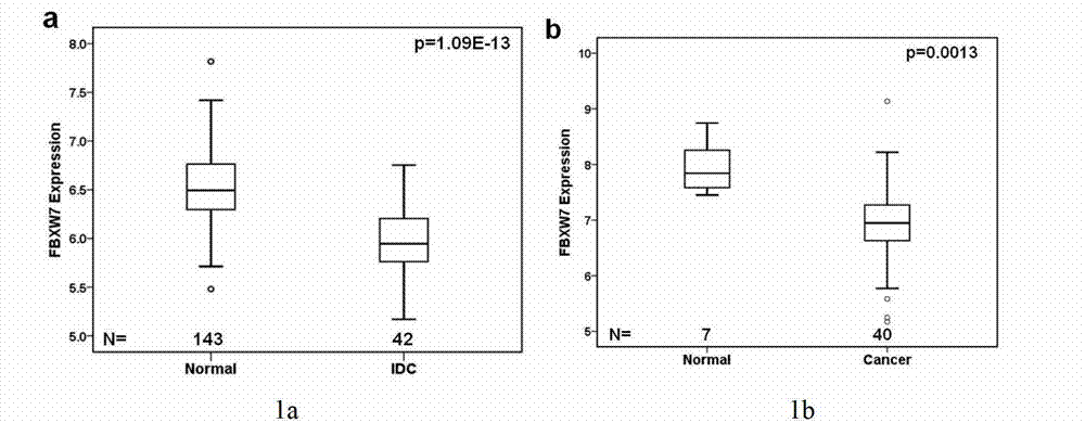 Application of cancer suppressor gene FBXW7 in preparation of drugs used for preventing or treating breast tumors, expression vector and diagnosis medicine