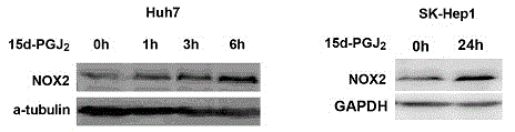 Inhibitor for hepatoma carcinoma cell and application to aspect of inhibiting tumor growth thereof