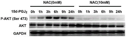 Inhibitor for hepatoma carcinoma cell and application to aspect of inhibiting tumor growth thereof