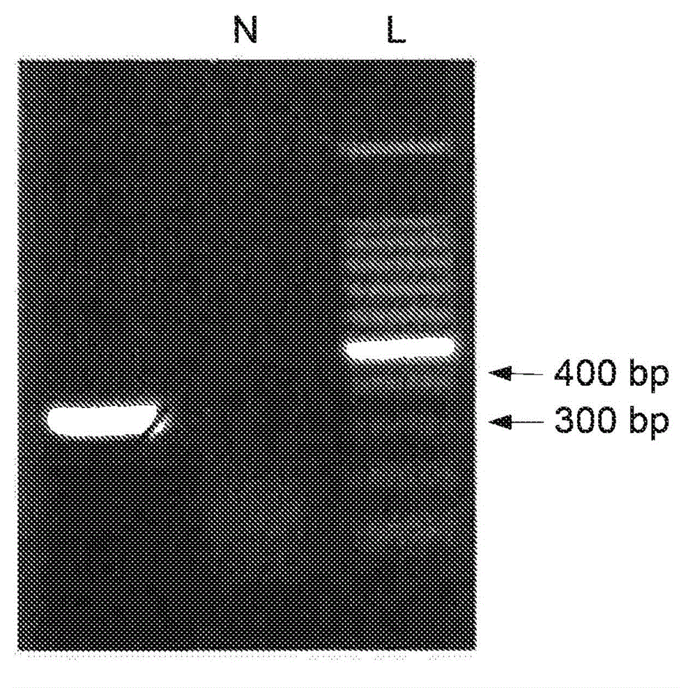 Chimeric momp antigen, method and use