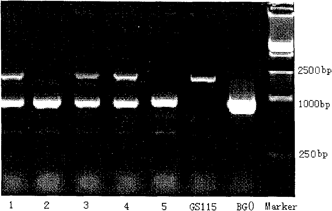 Batroxobin and its preparing process and specific coding gene