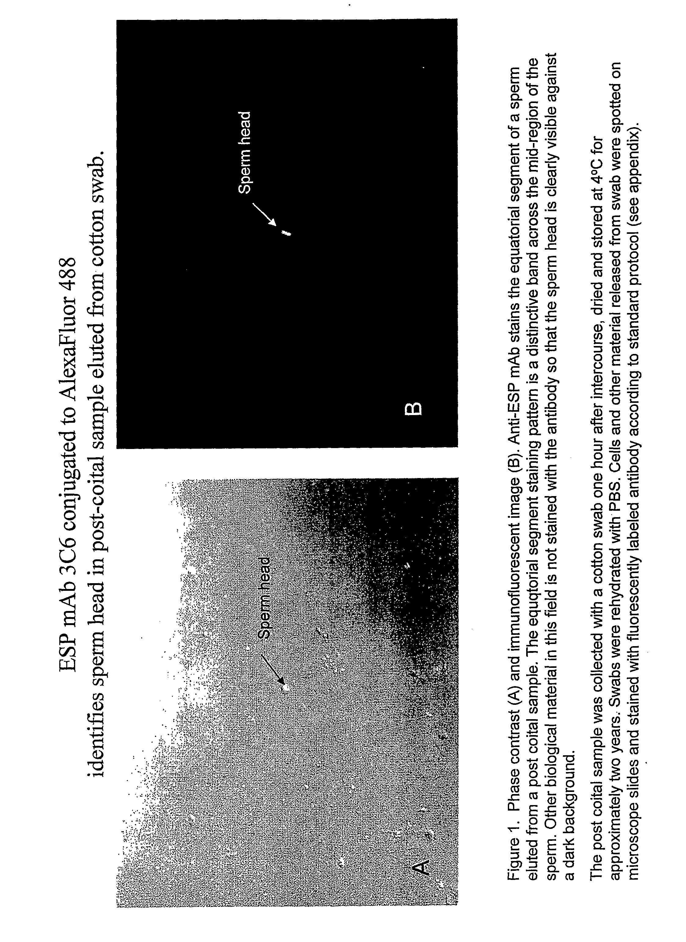 Compositions and Methods for Identifying Sperm for Forensic Applications