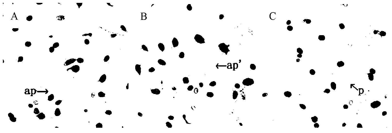 Method for separating and purifying antibacterial peptide of endophytic bacteria strain though high efficiency liquid chromatography