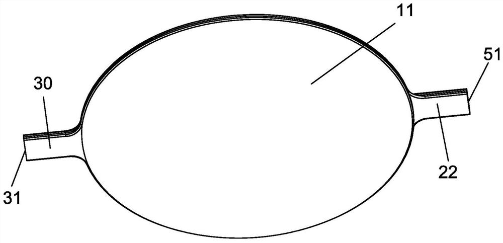 An ultra-thin microwave radiofrequency ablation heat dissipation patch