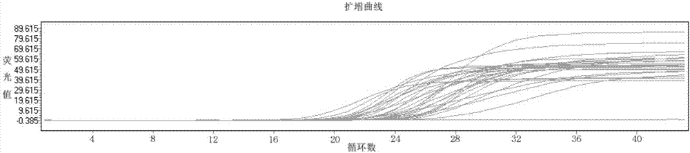 Kit and method for fluorescent quantitative detection of Bordetella pertussis