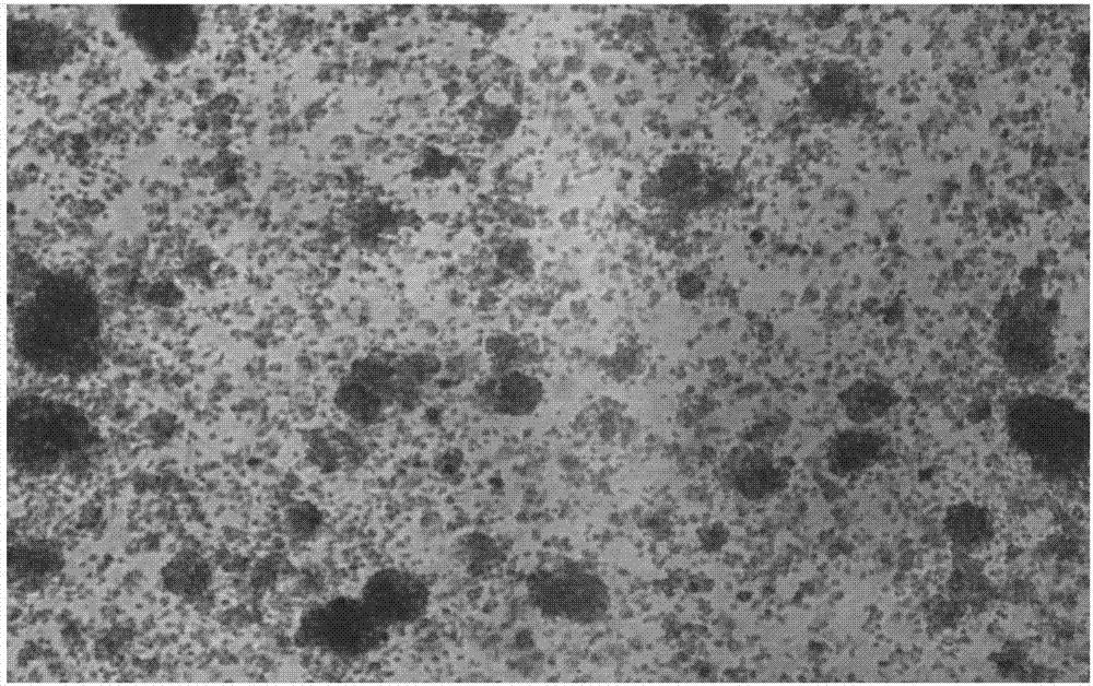 Method for in vitro activating and amplifying natural killer cells