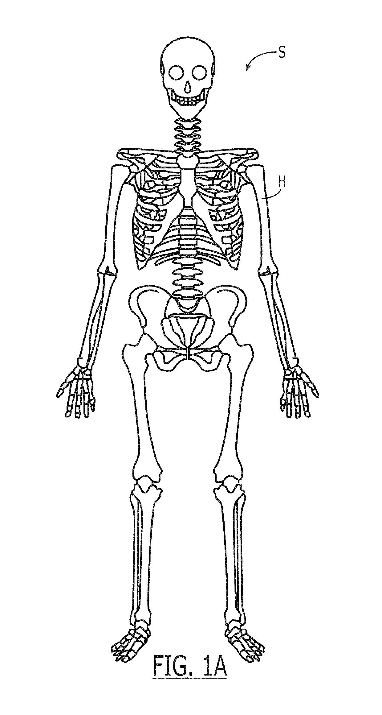 Proximal humeral fracture plate