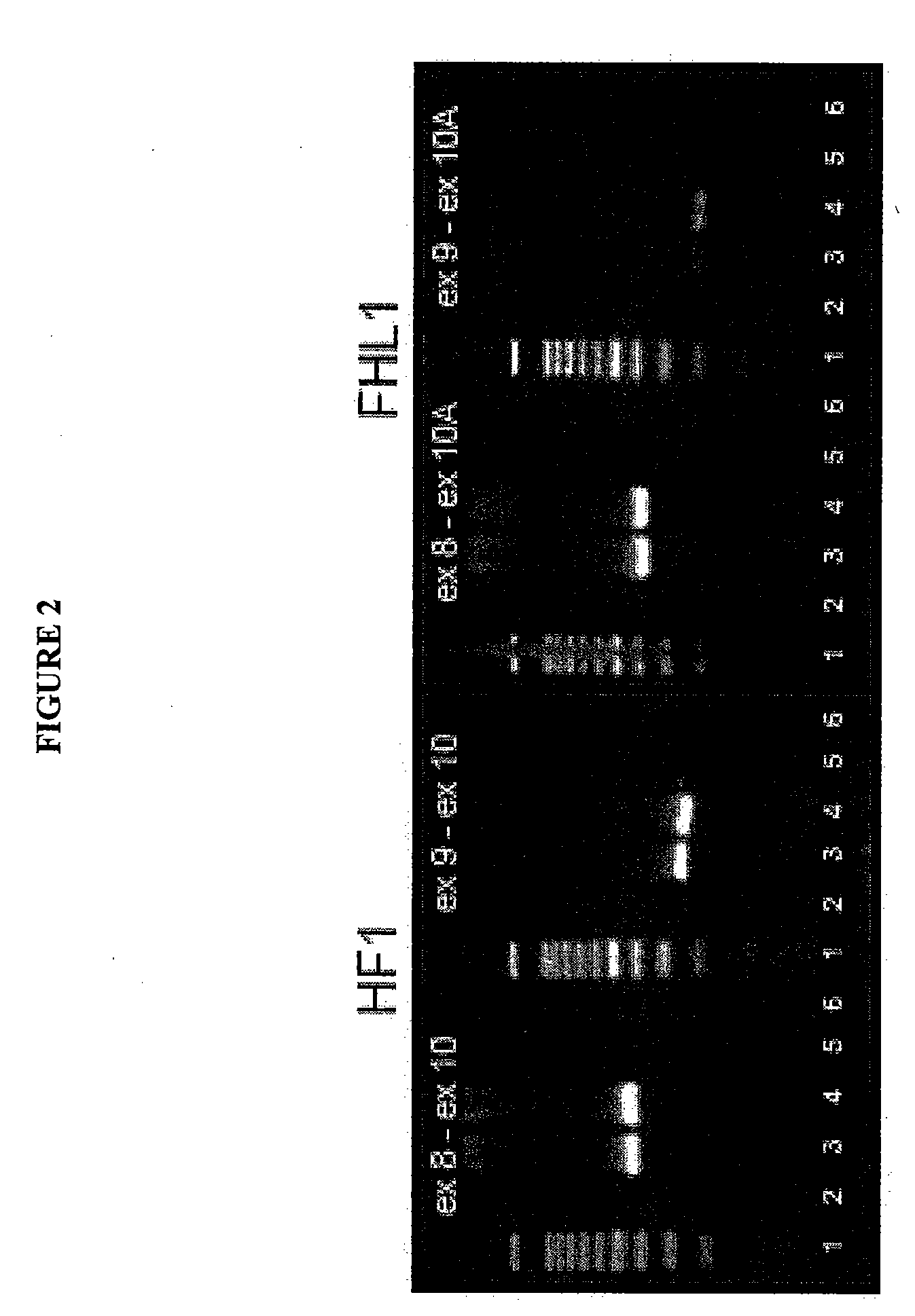 Therapeutic Compositions for Age-Related Macular Degeneration