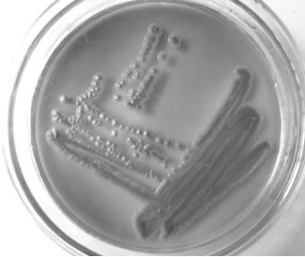 A strain of Rhodotorula biobversus producing carotenoids and its application