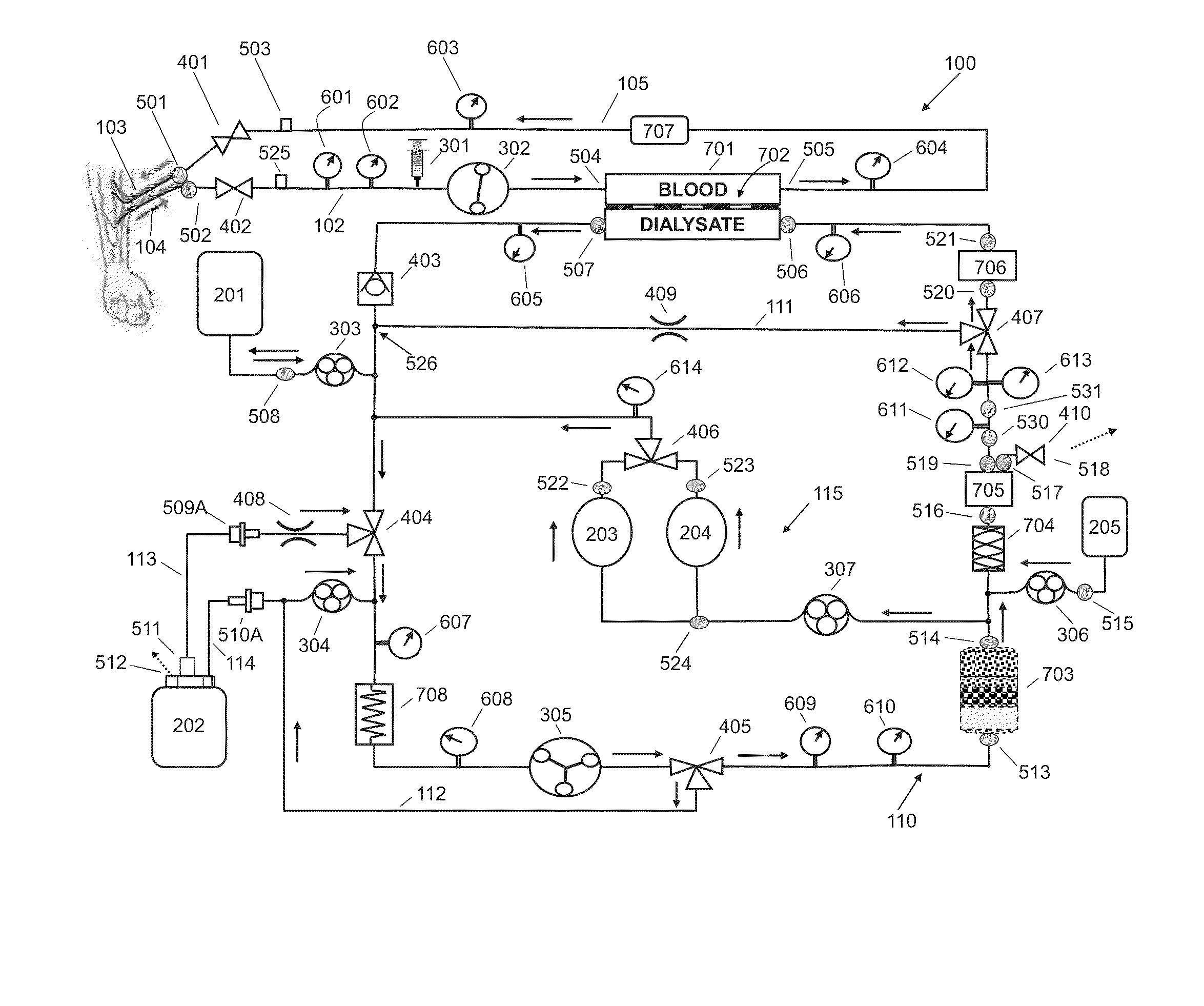 Fluid circuit for delivery of renal replacement therapies