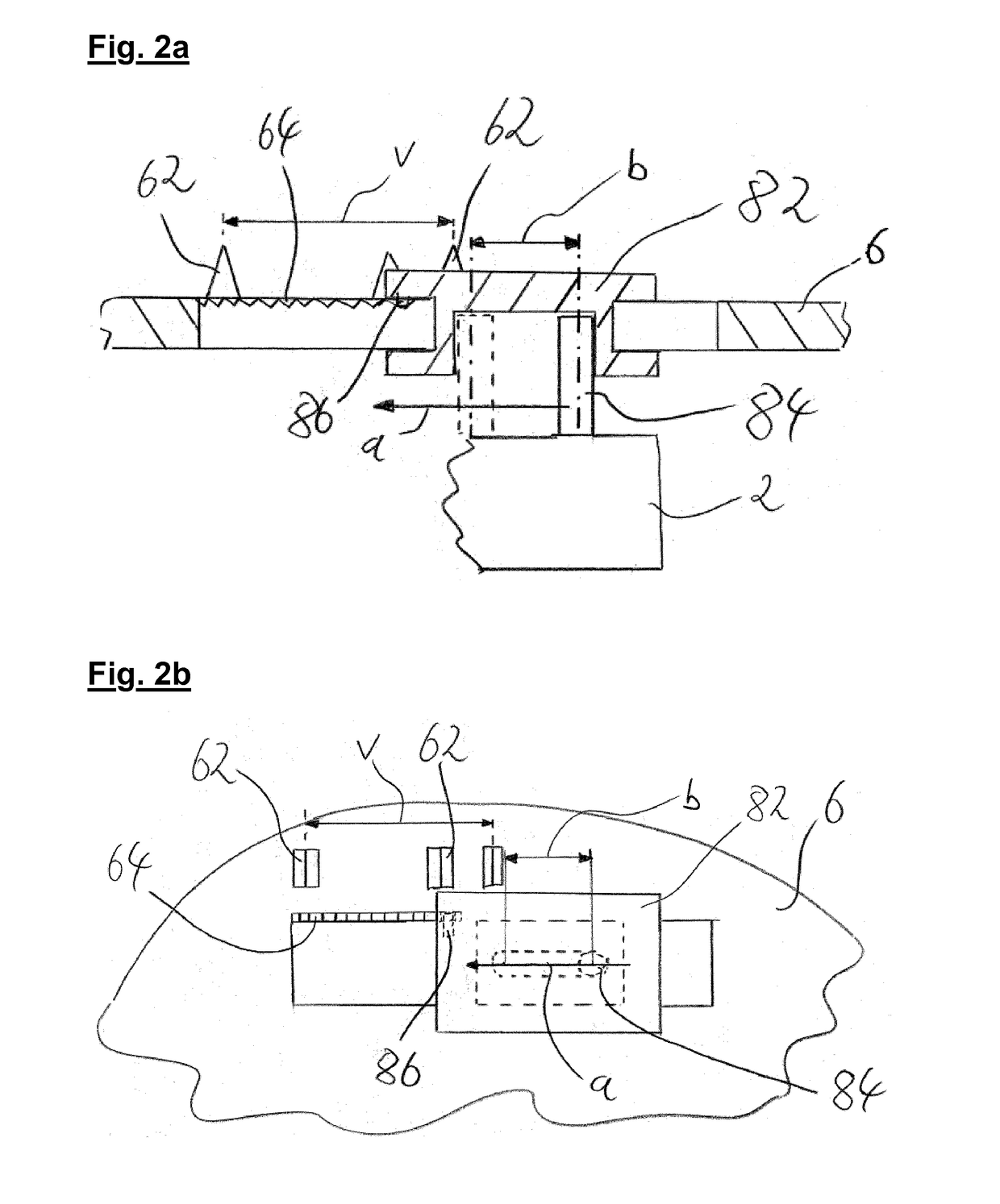 Braking System