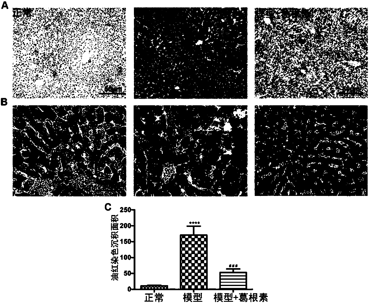 Application of puerarin in V crystal form in preparing drug for preventing and/or treating liver injuries caused by diabetes mellitus