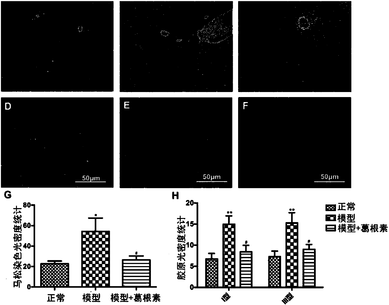 Application of puerarin in V crystal form in preparing drug for preventing and/or treating liver injuries caused by diabetes mellitus