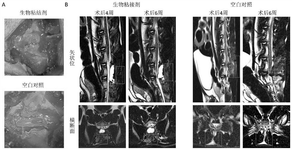 A kind of biological adhesive and its preparation method and application