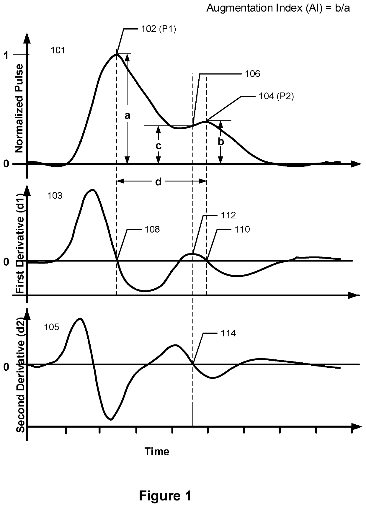 Photoplethysmography-based pulse wave analysis using a wearable device