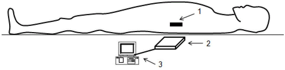 Electromagnetic controllable occlusion system for celiac great vessels