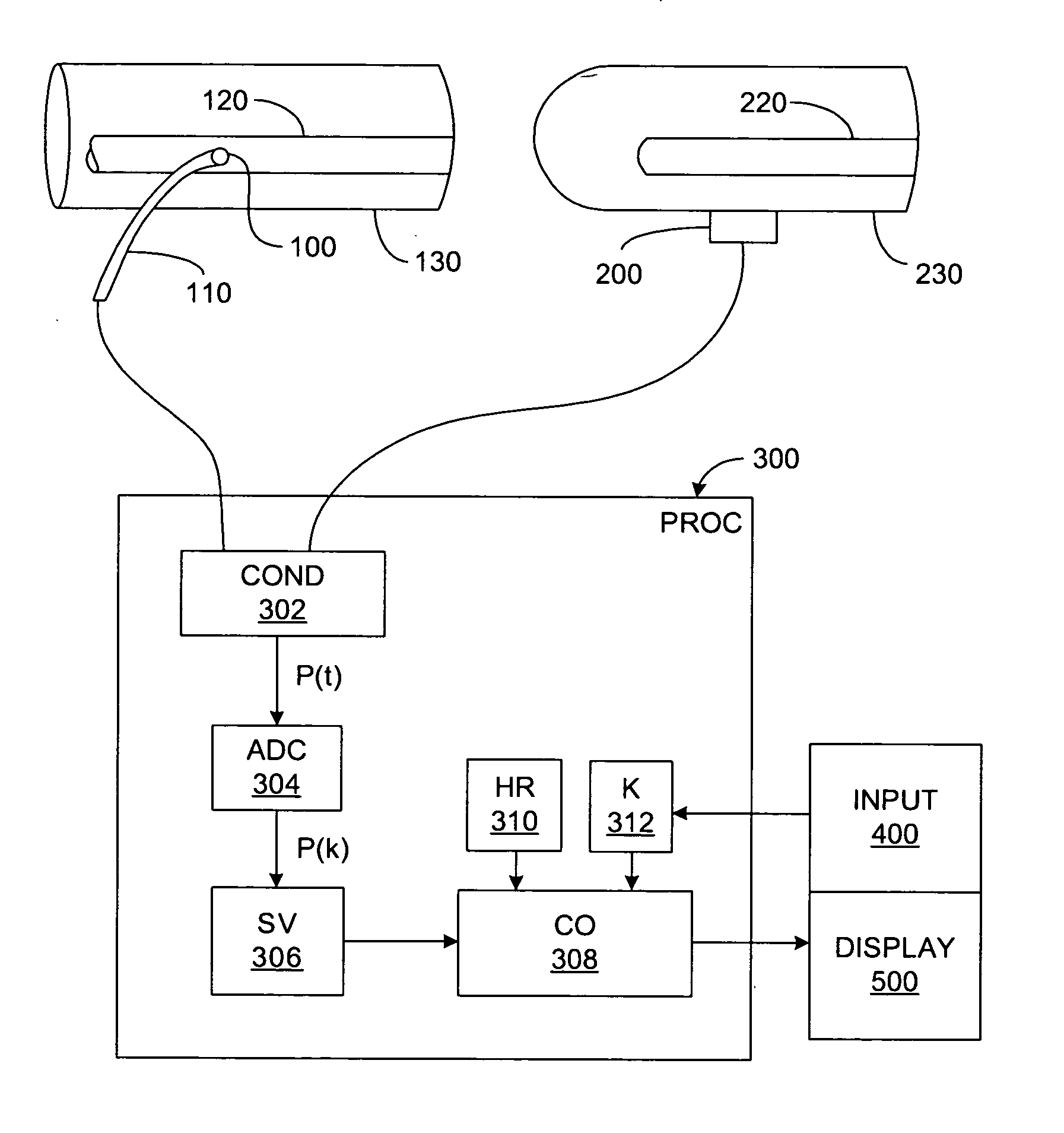 Pressure-based system and method for determining cardiac stroke volume