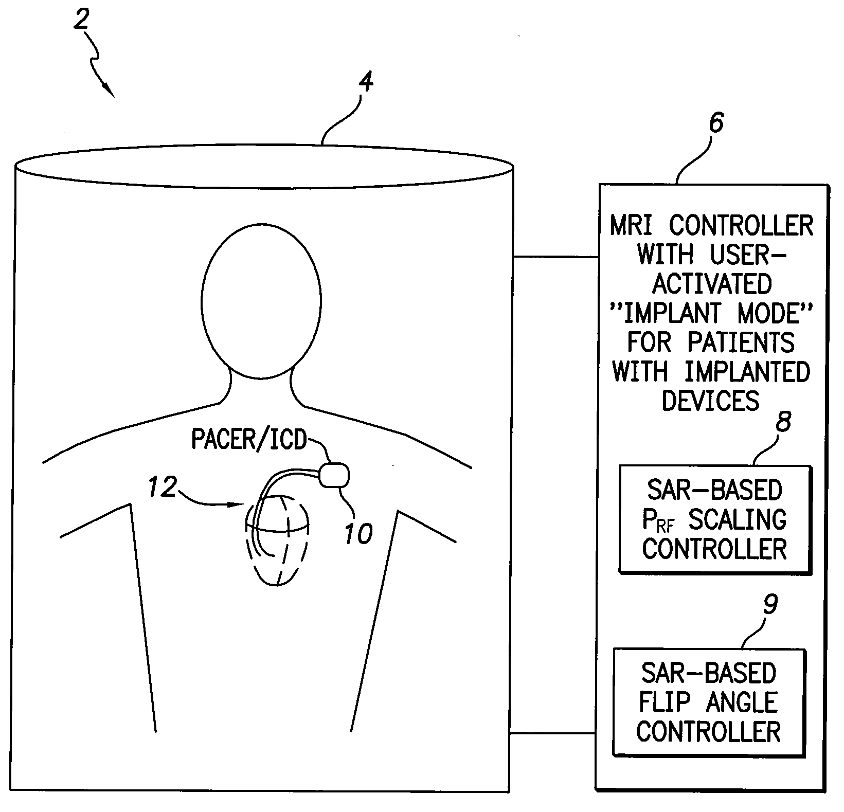 Systems and Methods for Reducing RF Power or Adjusting Flip Angles During an MRI for Patients with Implantable Medical Devices