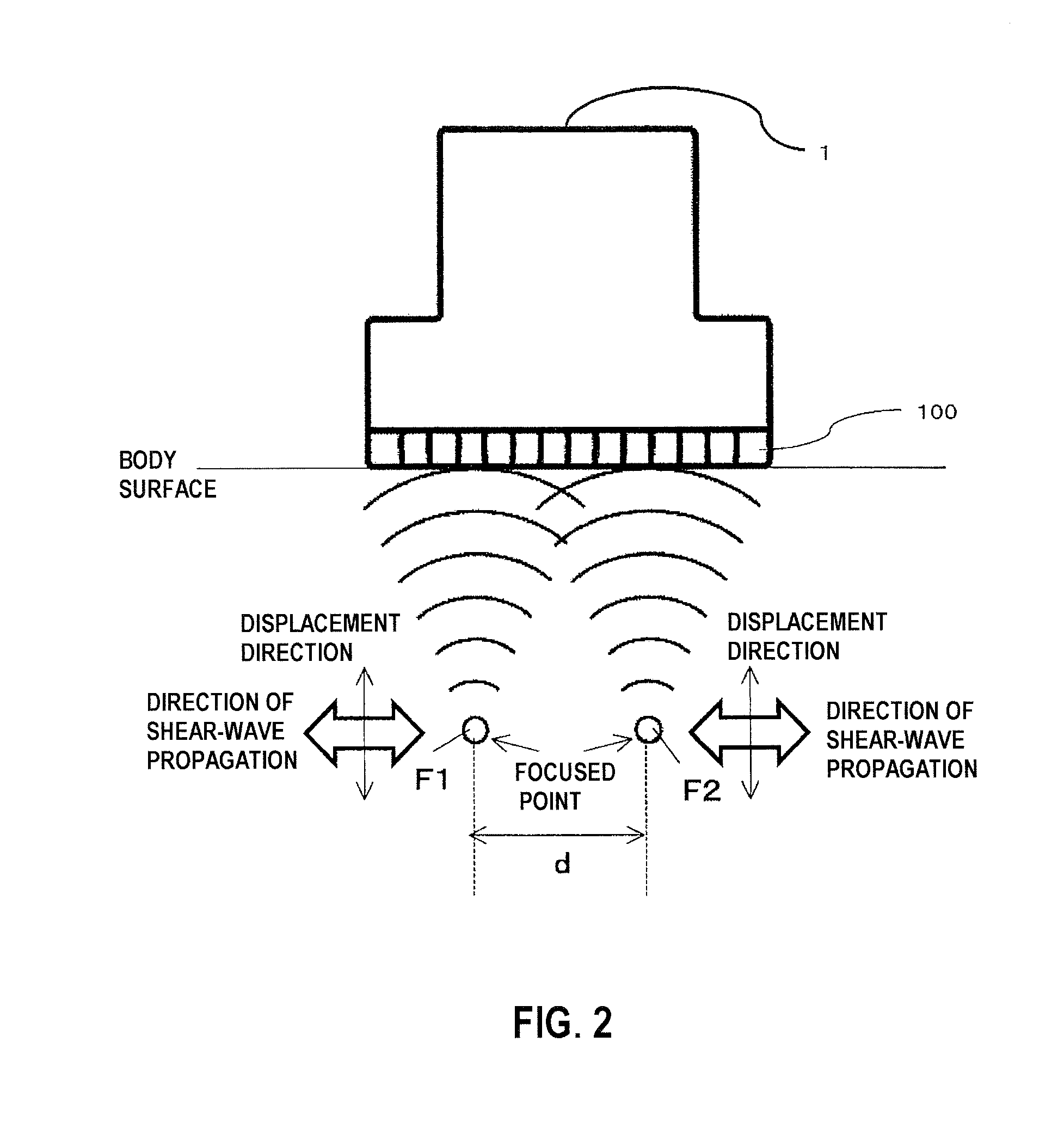 Ultrasonic diagnostic device