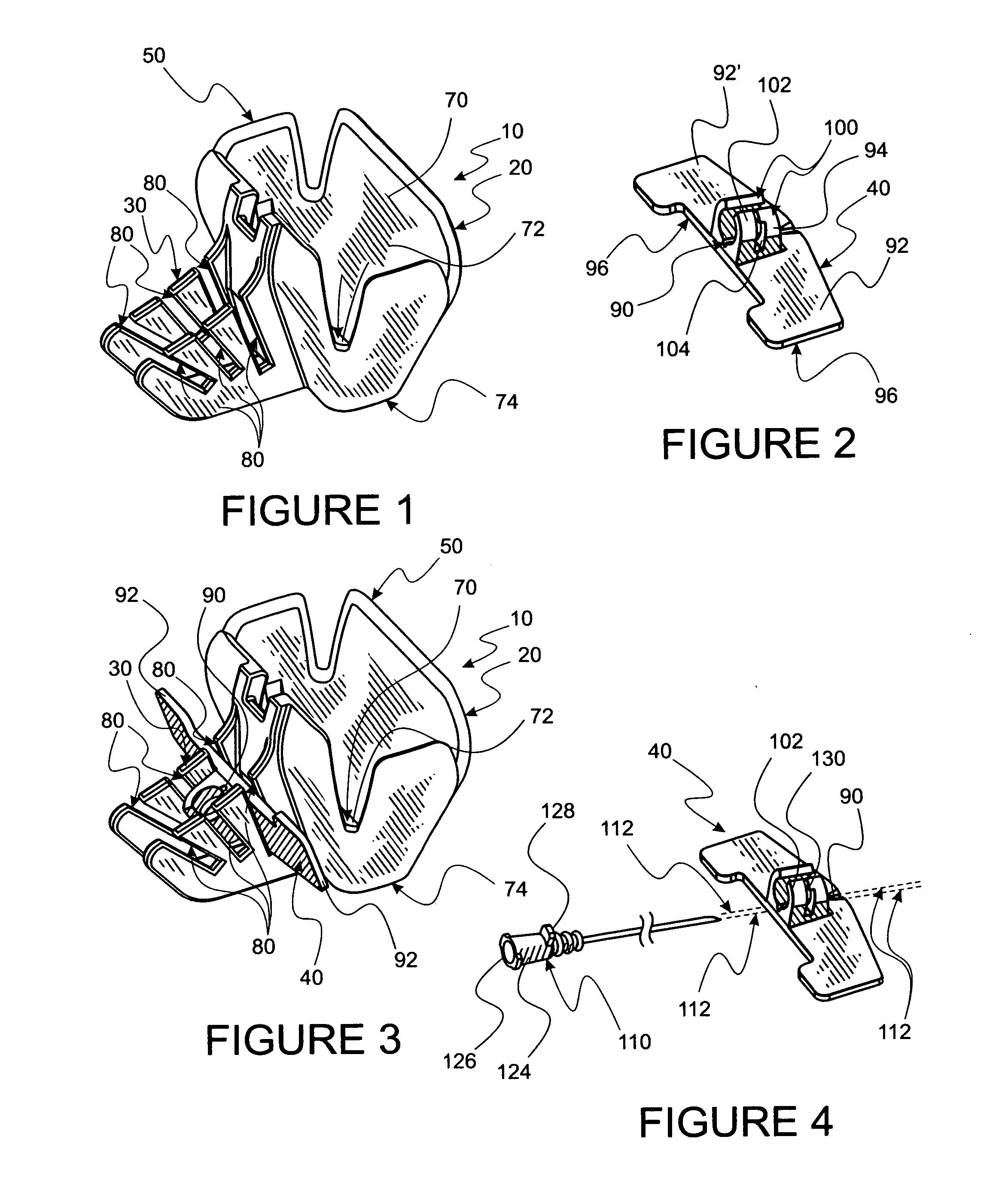 Vascular acess device ultrasound guidance system