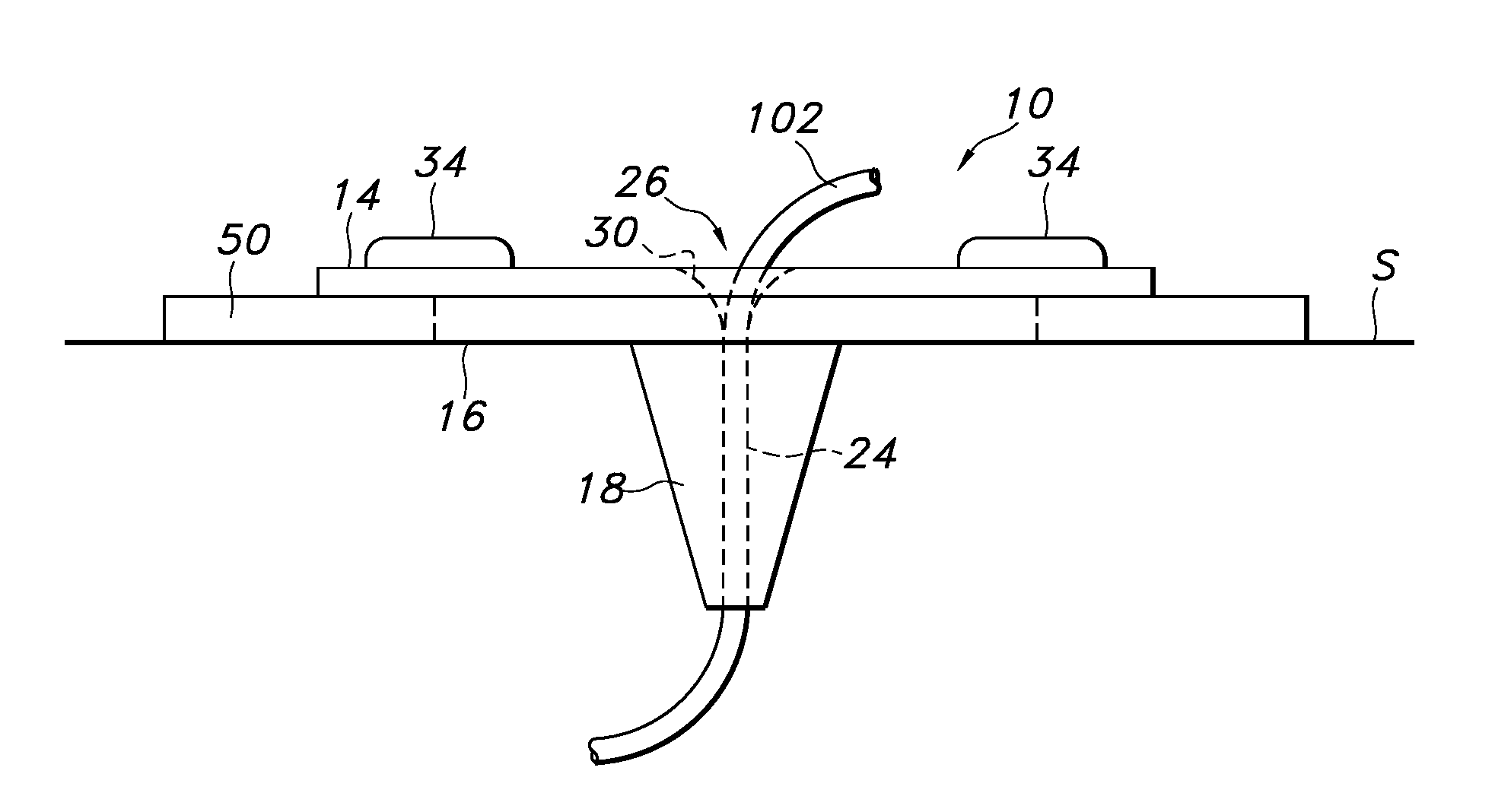 Catheter insertion site plug