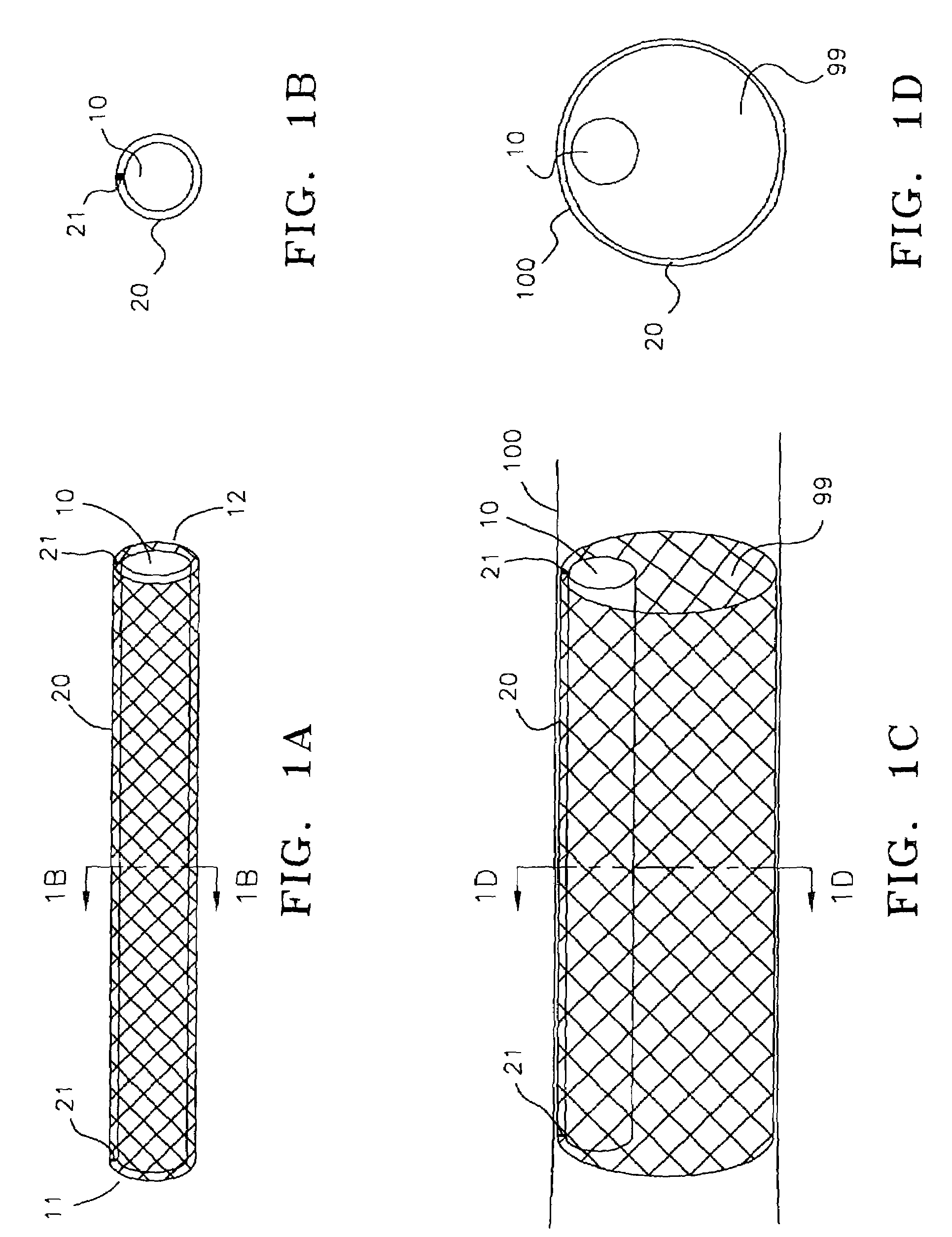 Endoscopic arterial pumps for treatment of cardiac insufficiency and venous pumps for right-sided cardiac support