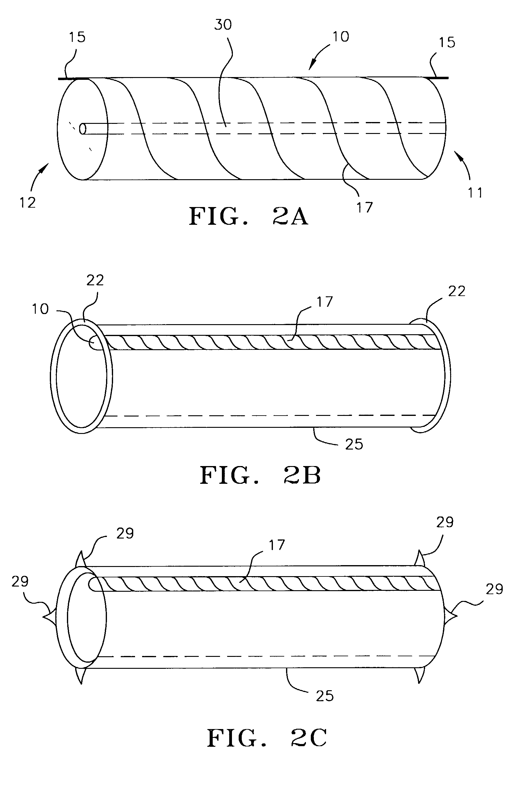 Endoscopic arterial pumps for treatment of cardiac insufficiency and venous pumps for right-sided cardiac support