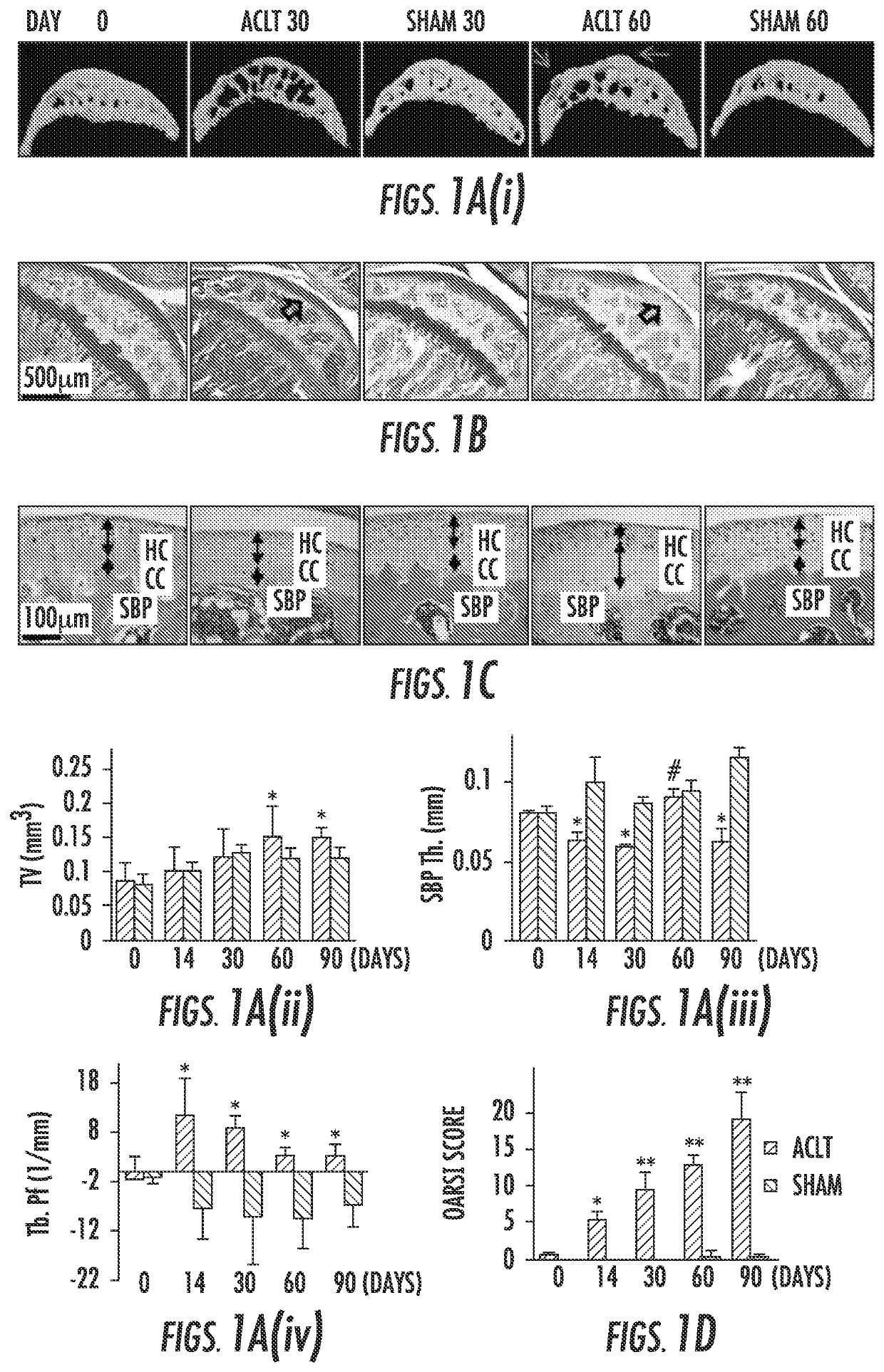 Compositions and methods for treating or preventing osteoarthritis