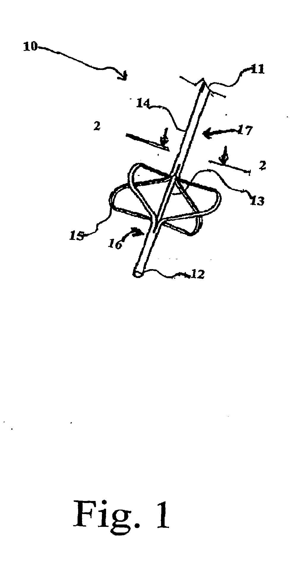 Article and method for openings in lumens