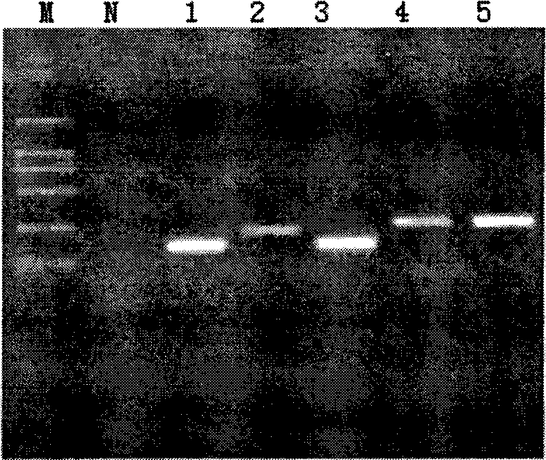 Human papilloma virus infection gene amplification fluorescent detection kit