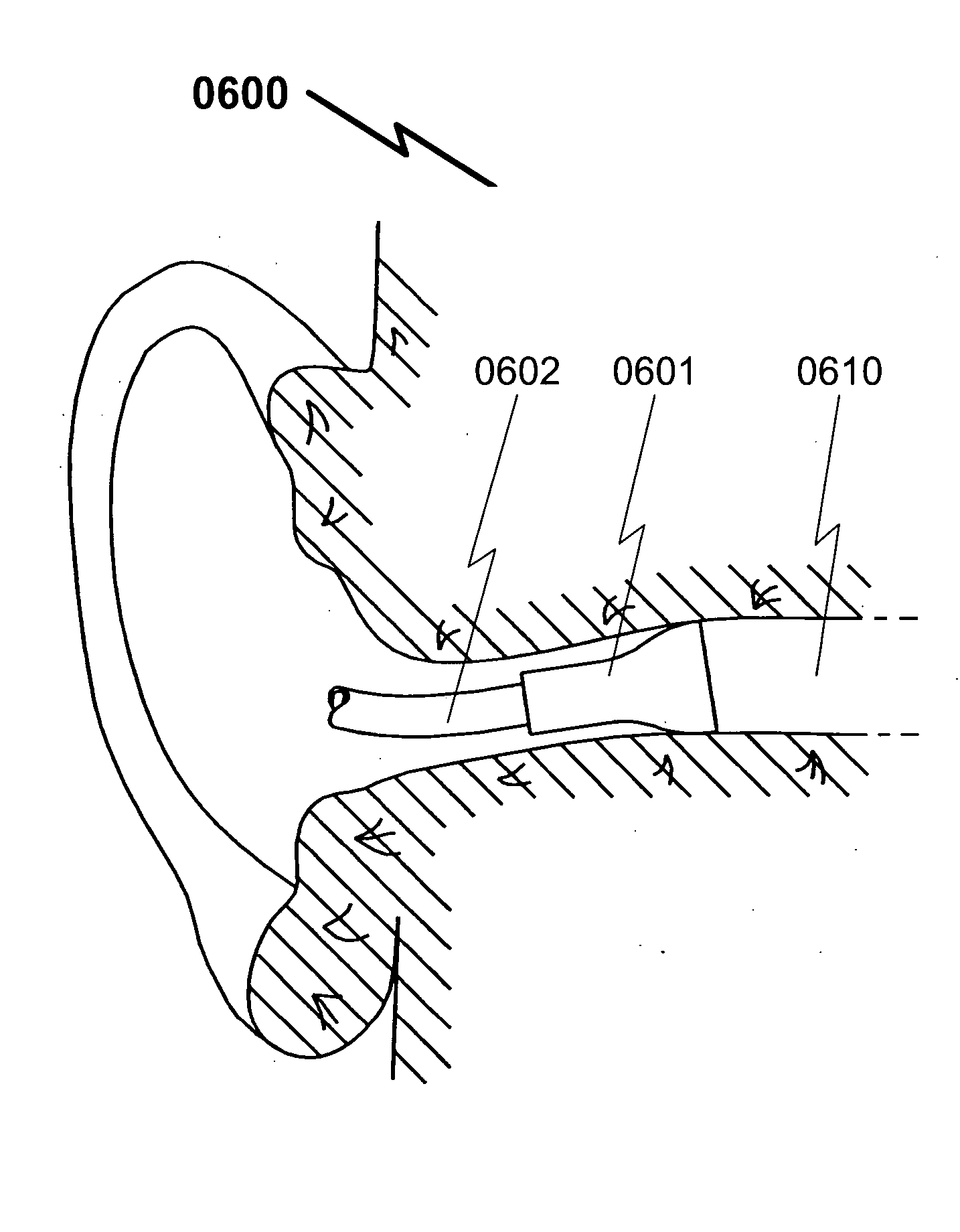 Hearing aid eartip