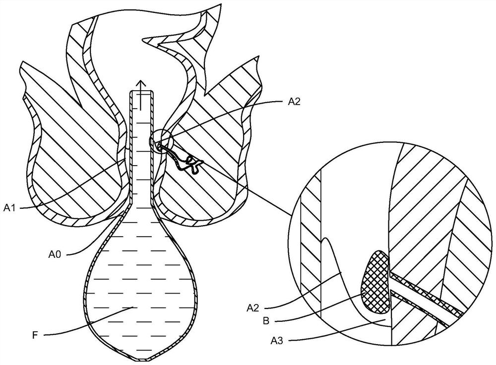 Rectal administration device