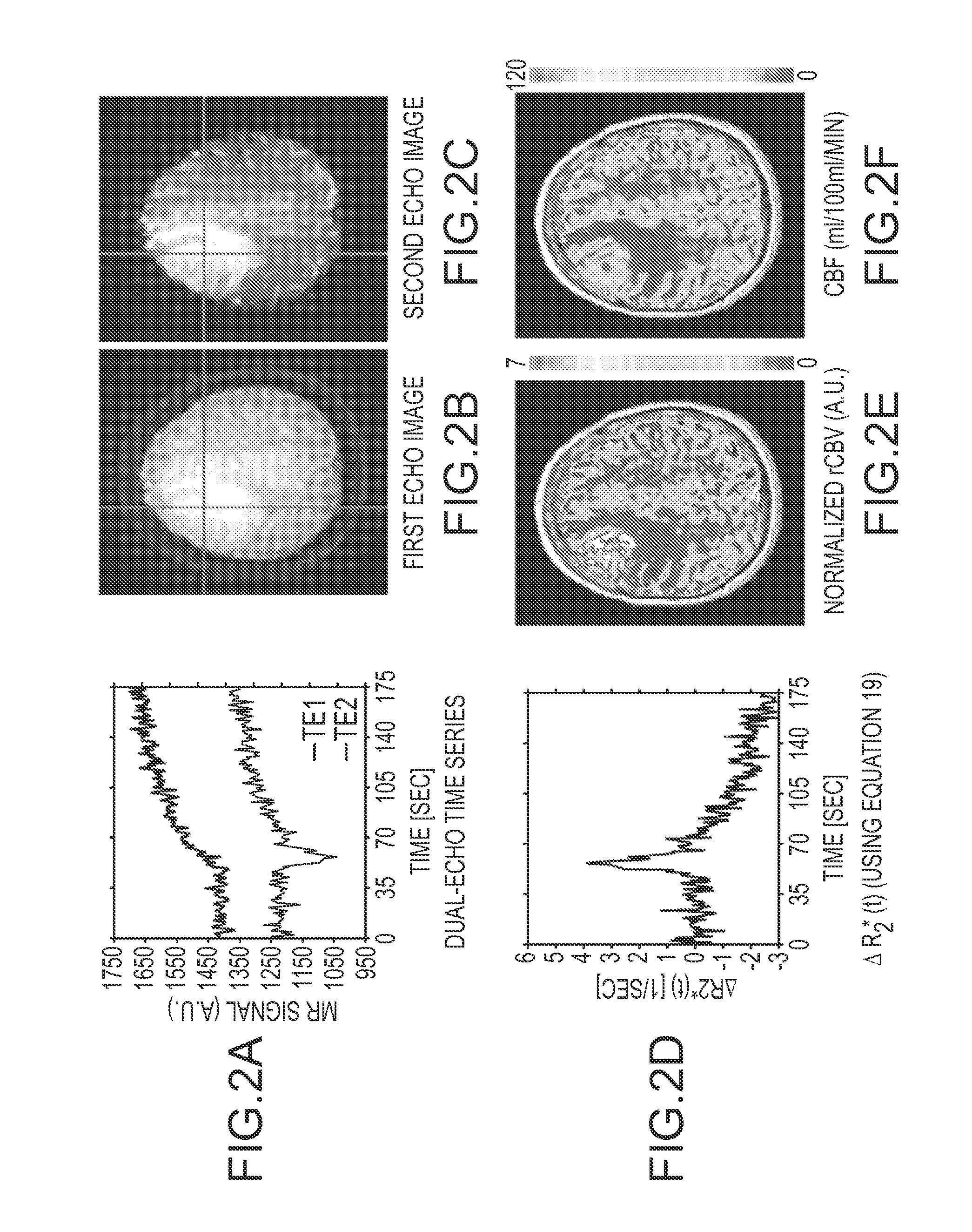 Multiparameter perfusion imaging with leakage correction