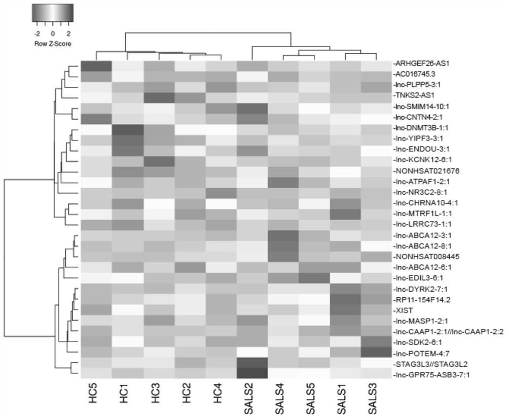 Biomarker for early diagnosis of sporadic amyotrophic lateral sclerosis and Parkinson's disease and application thereof