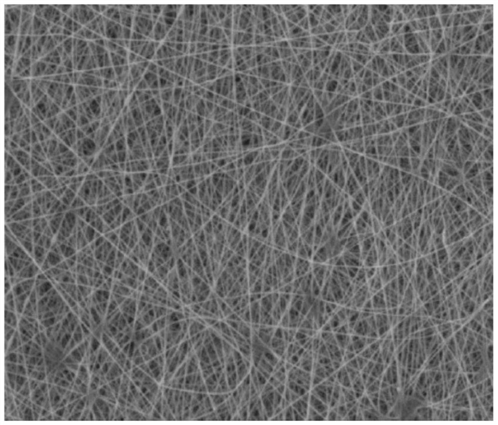 A multi-layer anti-infection high-strength artificial dura mater and its preparation method