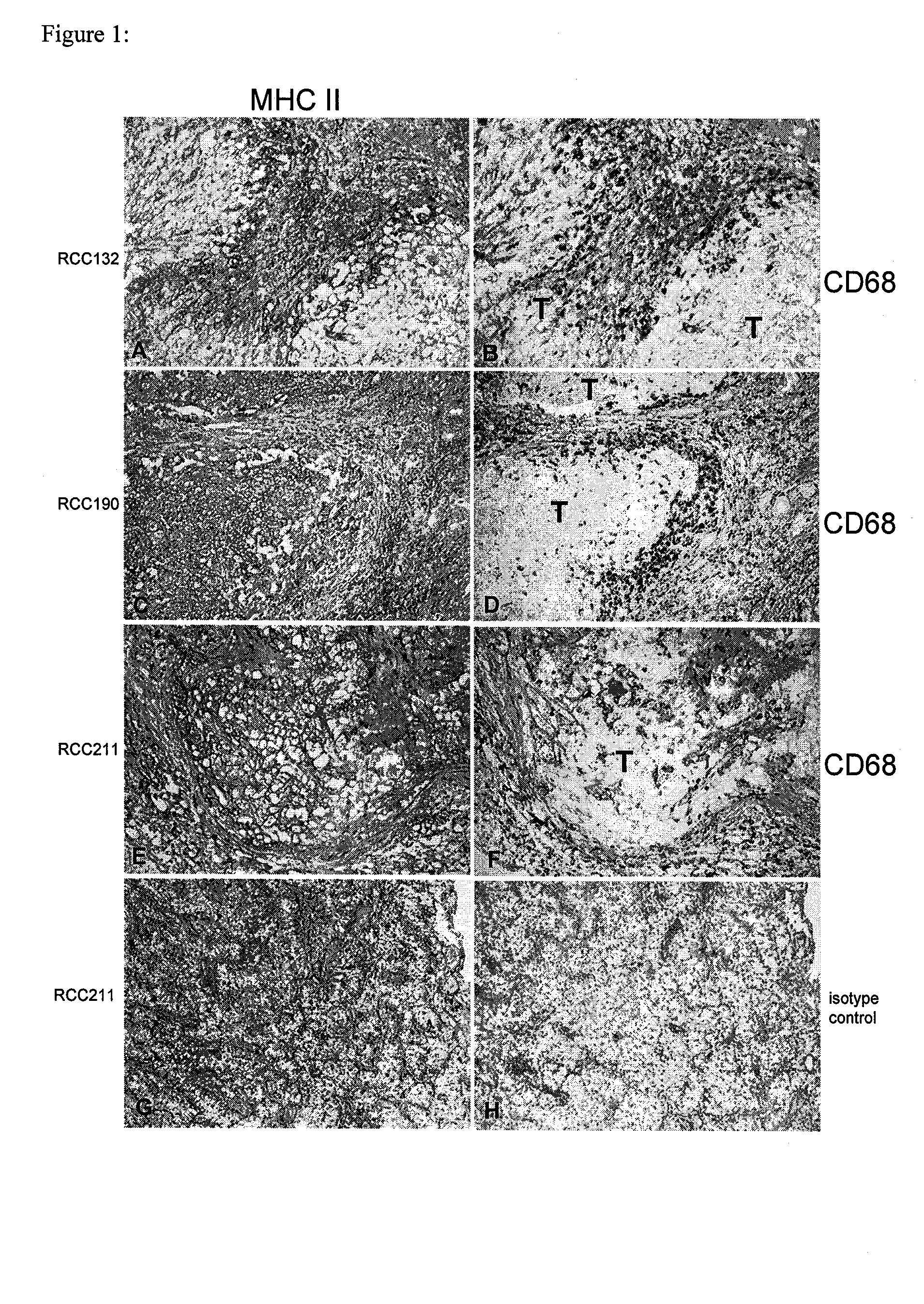 Tumor-associated peptides binding to human leukocyte antigen (HLA) class II molecules