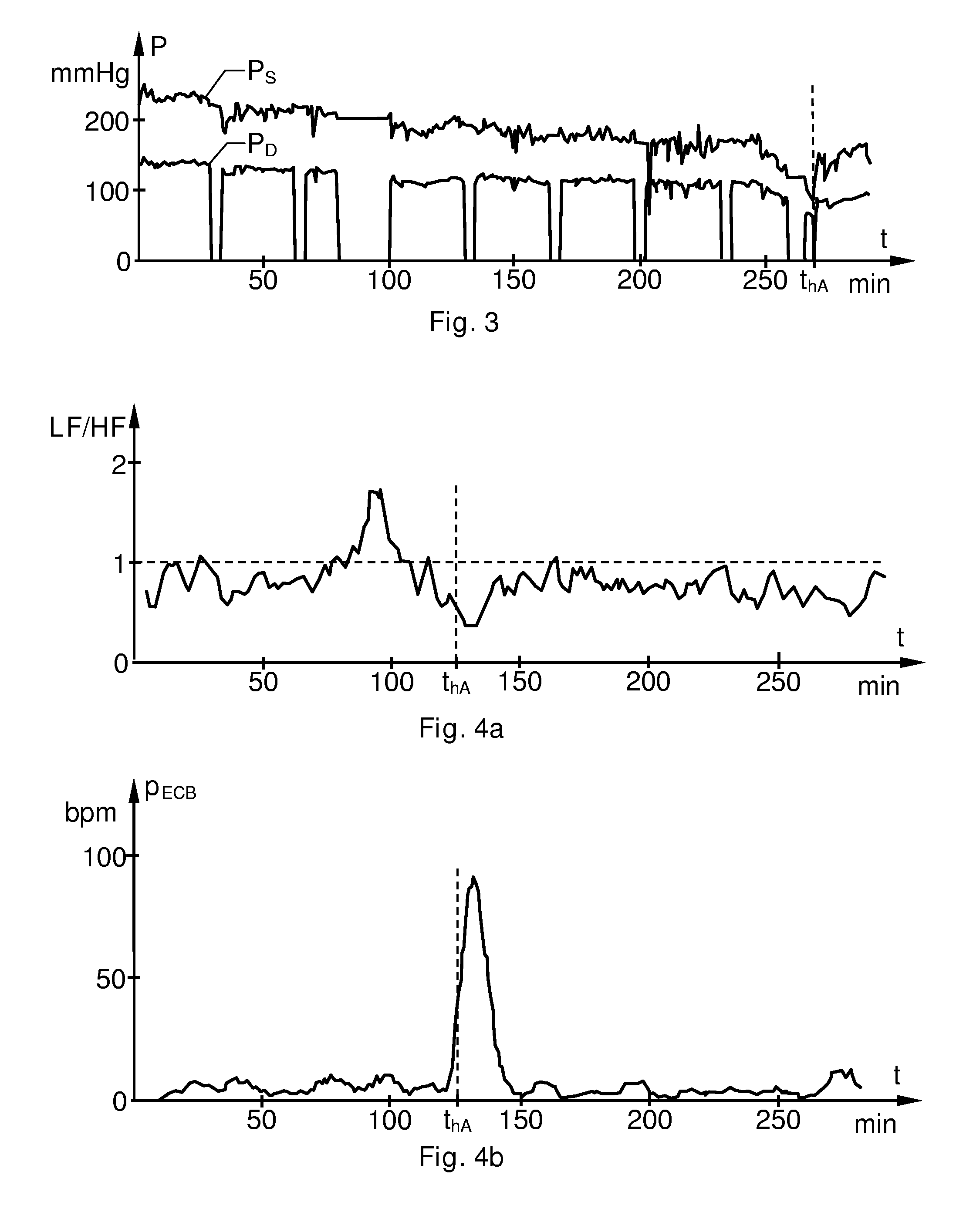 Detection of Drastic Blood Pressure Changes