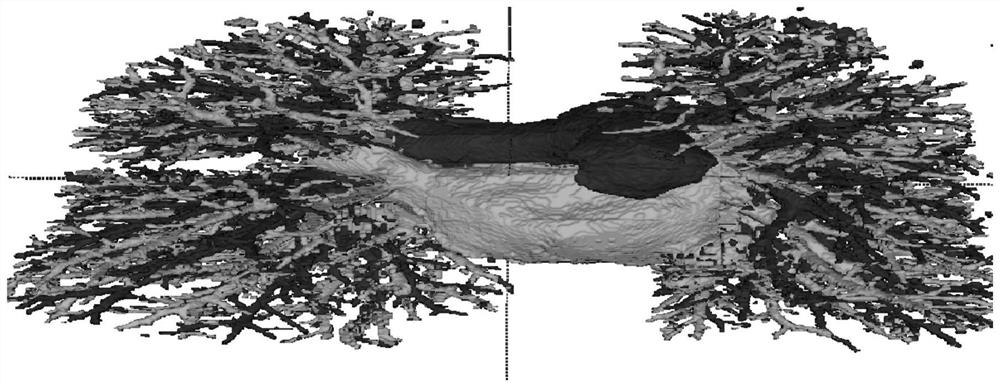 Pulmonary vessel segmentation method and device, storage medium and electronic equipment