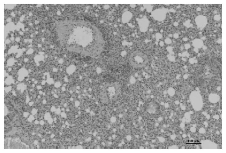 Application of traditional Chinese medicine composition in preparation of anti-inflammatory medicine and/or immunomodulatory medicine