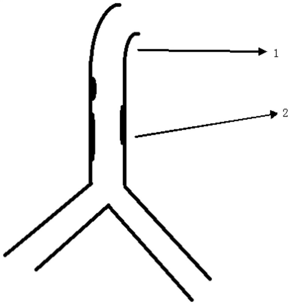 Vascular stent construction method based on modularization