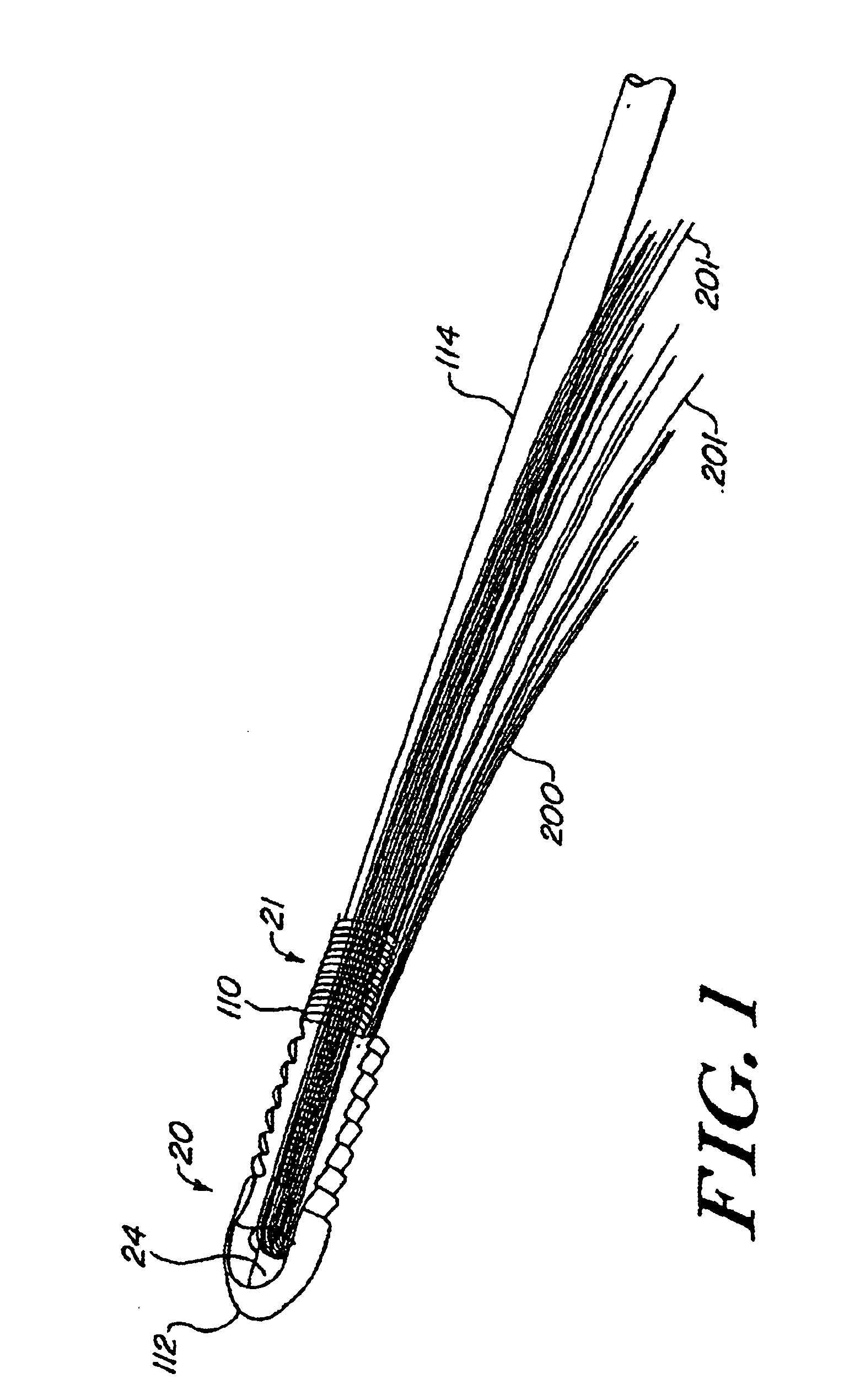 Expanding ligament graft fixation system and method