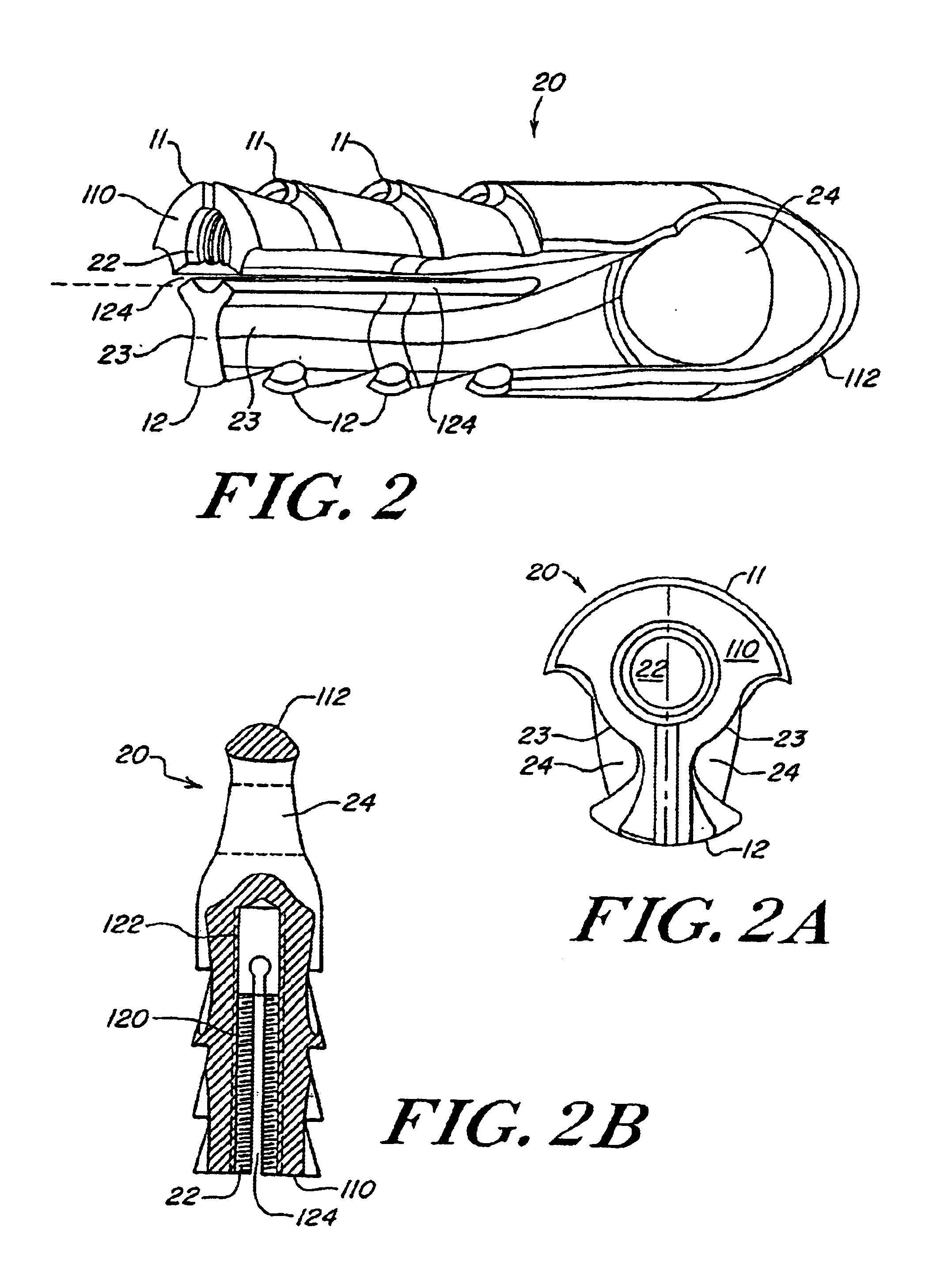 Expanding ligament graft fixation system and method