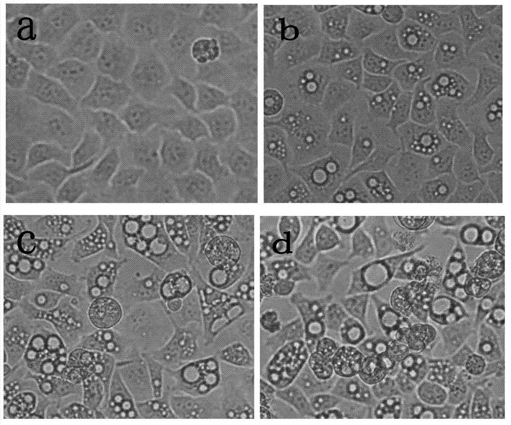 Application of fructus akebiae extract in preparation of drug for treating primary hepatic carcinoma