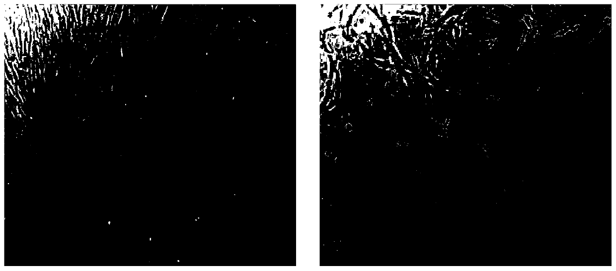 Isolated culture and neural directional differentiation method of deciduous tooth pulp stem cells