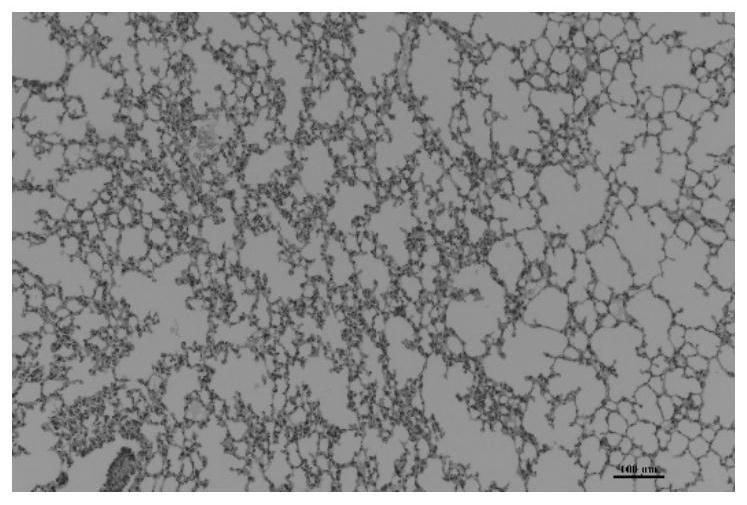 Application of traditional Chinese medicine composition and/or pharmaceutical preparation containing traditional Chinese medicine composition in preparation of anti-inflammatory drugs or immunomodulatory drugs