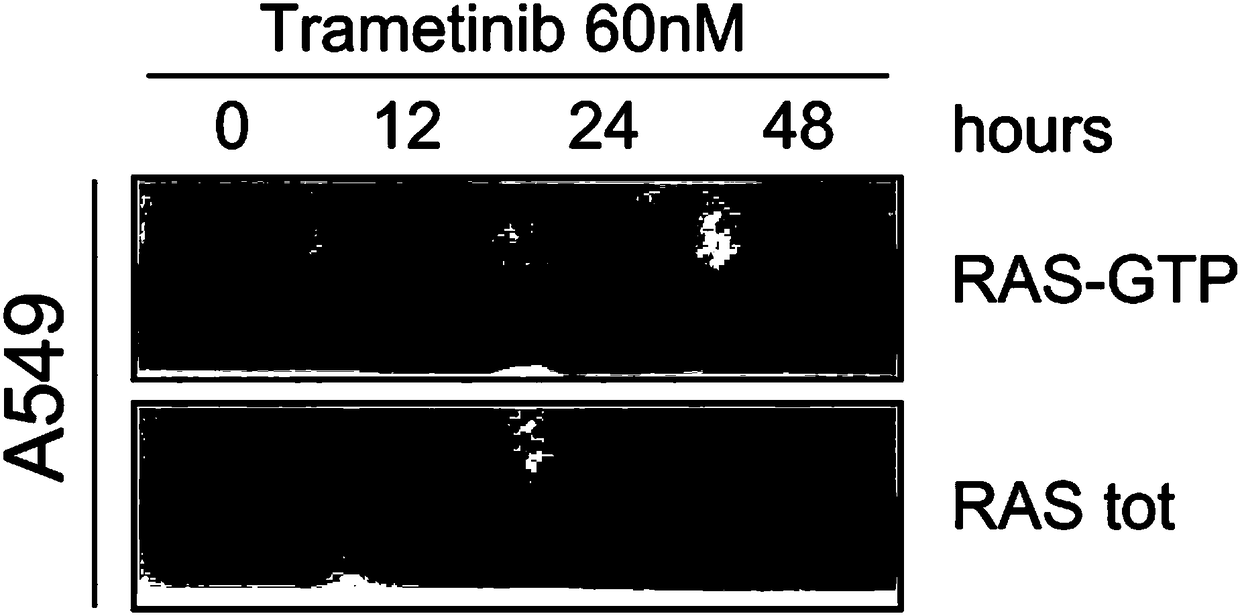 Combined drug for treating tumors