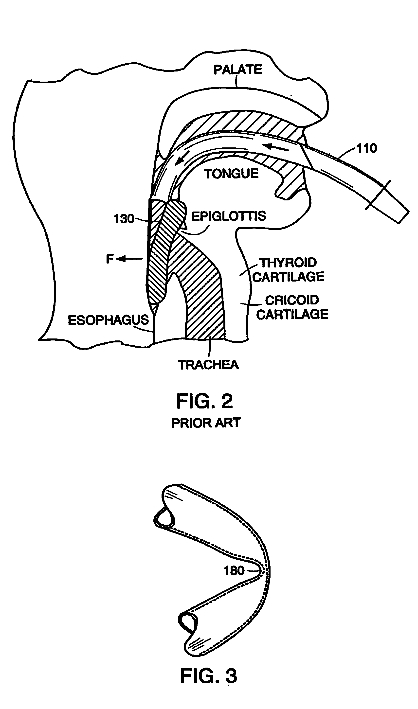 Laryngeal mask airway device with airway tube having flattened outer circumference and elliptical inner airway passage