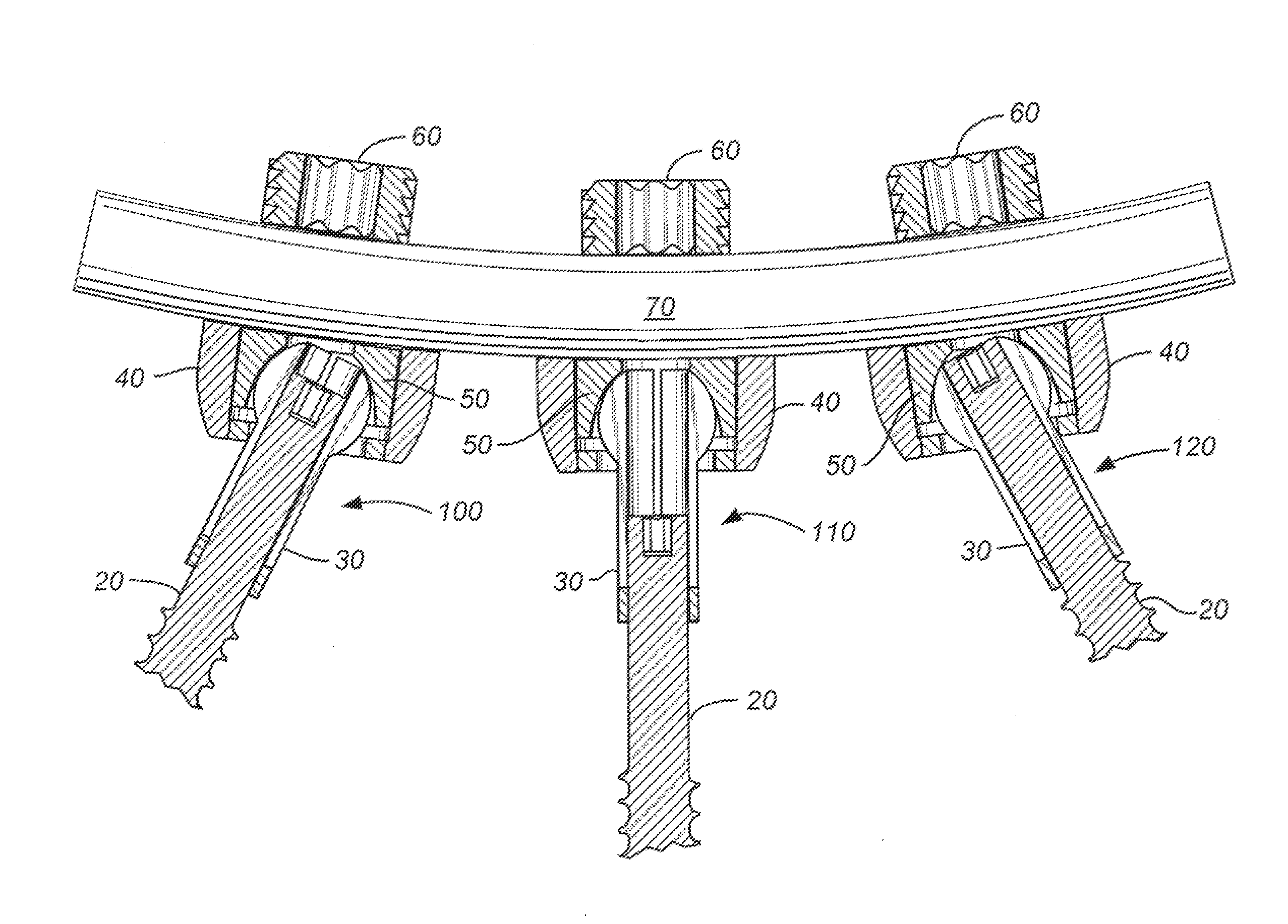 Variable height, multi-axial bone screw assembly