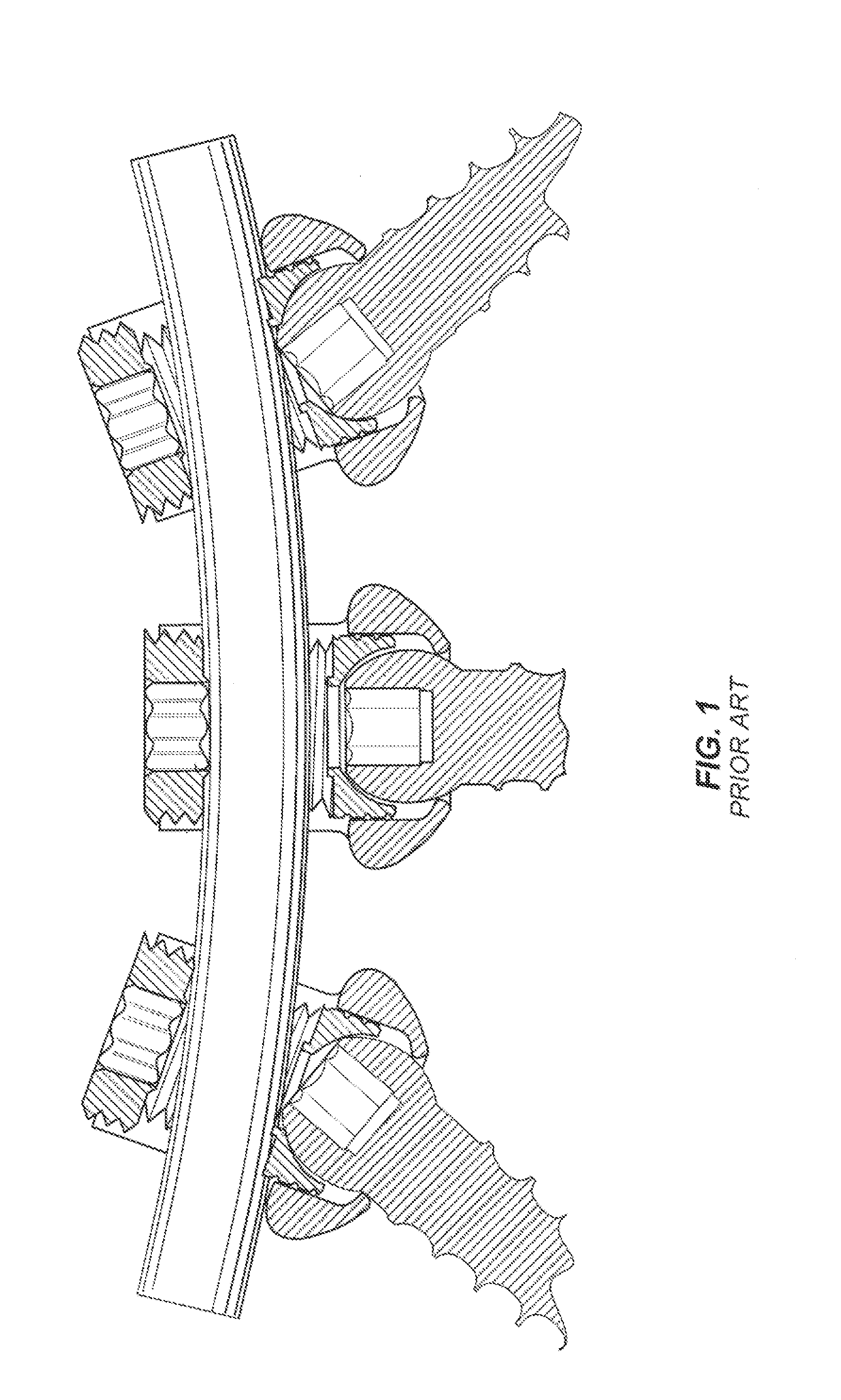 Variable height, multi-axial bone screw assembly