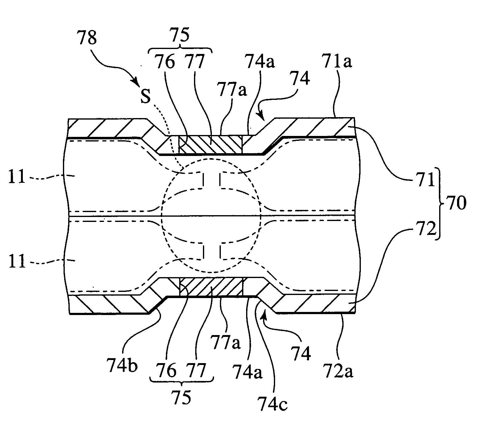 Battery accommodation casing, battery module and assembled battery